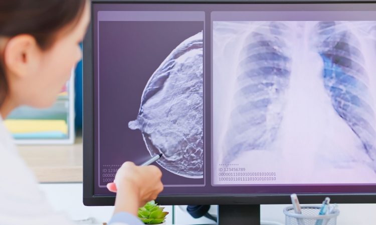 V Litiji začeli slikanje žensk v programu Dora
