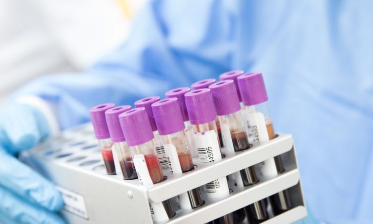Tehnične težave v centralnem laboratoriju UKC Ljubljana povzročajo zamude v urgentnem centru